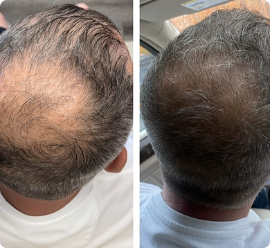 before-after-1 1