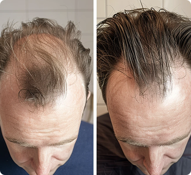 before-after-1 2