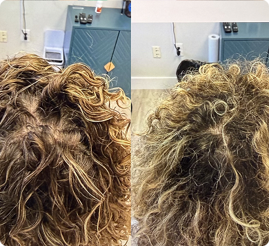 before-after-1 3